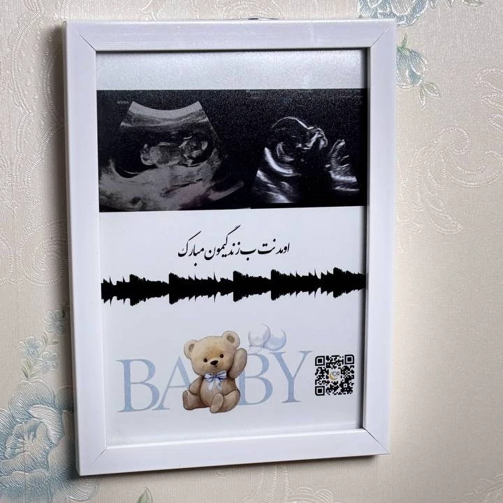 قاب موزیکال(سونوگرافی و بارکدصدای ضربان قلب جنین شما)سایز 16در21
