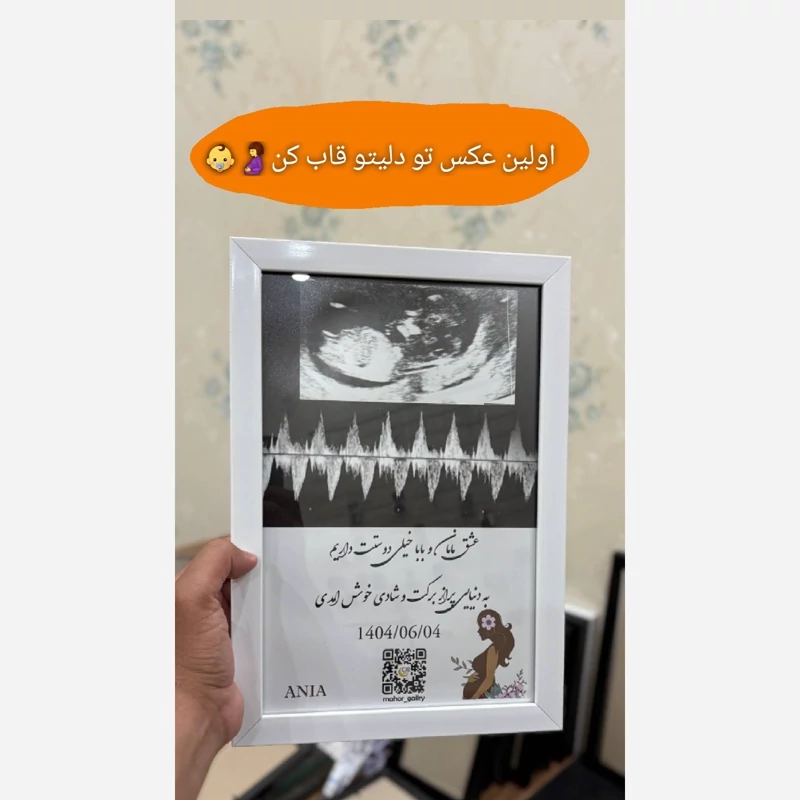 قاب موزیکال(سونوگرافی و بارکدصدای ضربان قلب جنین شما)